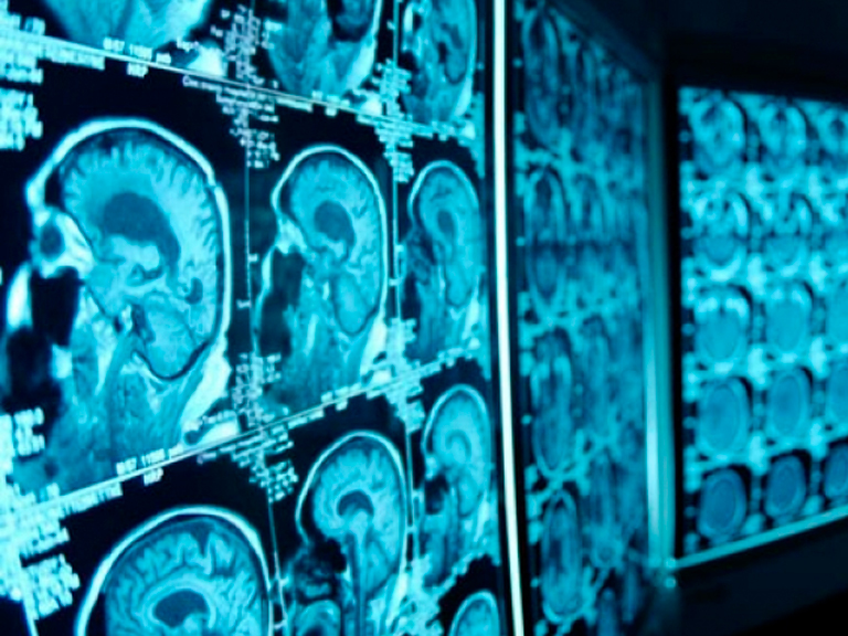 Investigadores de Neurociencias colaborarán con el desarrollo minero