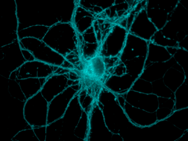 Research Associate position available at the Laboratory for Neurodegenerative Disease Research Ruđer Bošković Institute – Zagreb