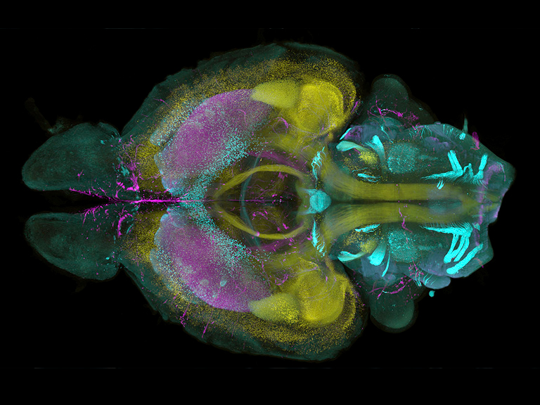 Nueva técnica permite observar detalladamente el cerebro en 3D