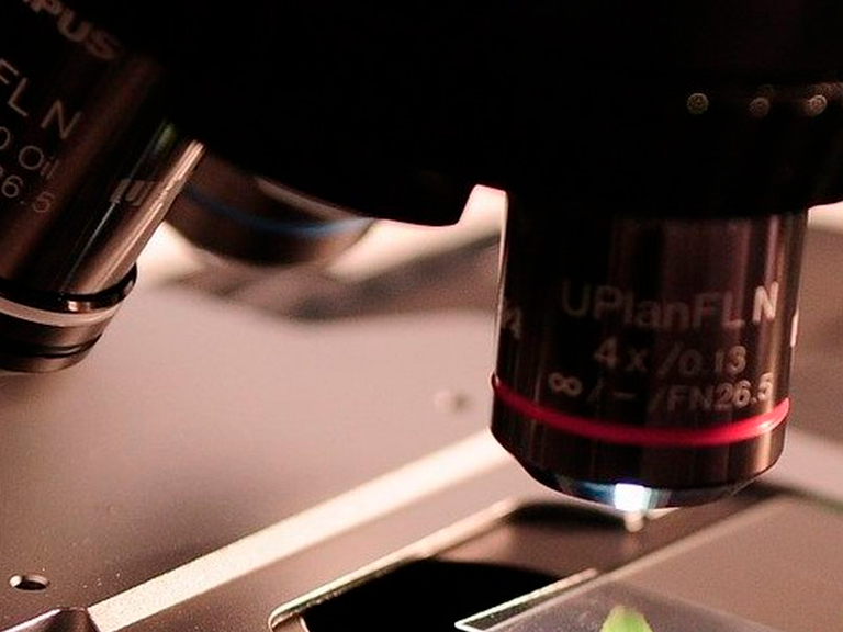 Científicos chilenos crean y patentan nueva e innovadora terapia para mortal enfermedad neurodegenerativa