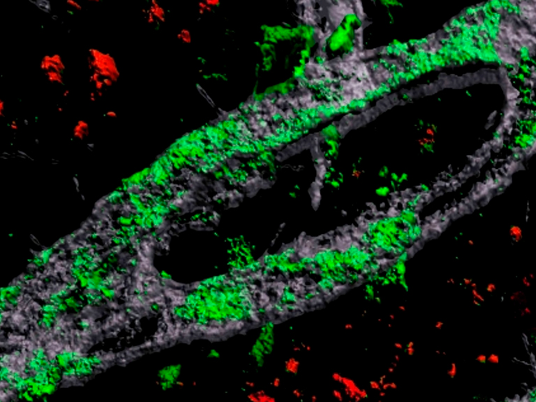 Estudio identificó el tipo específico de células vasculares y la vía molecular a través de la cual la variante APOE4 promueve el Alzheimer