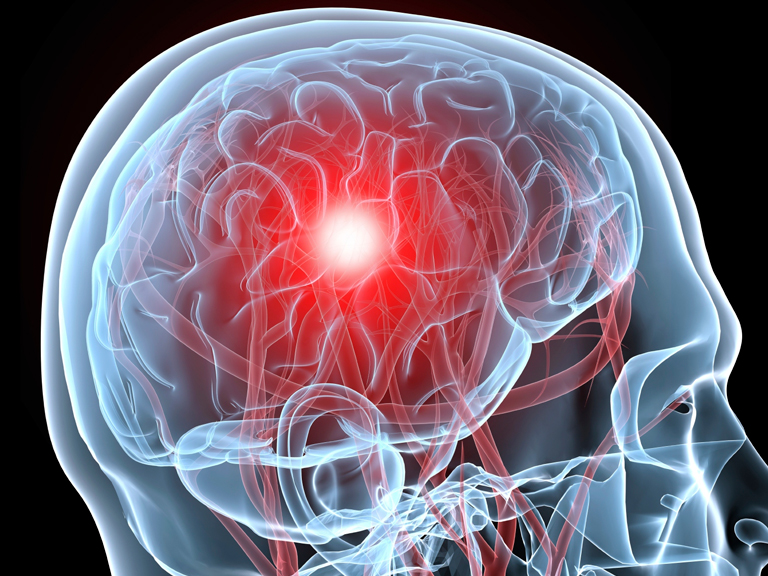 Primer éxito mundial de la biomedicina chilena: terapia génica para tratar enfermedades neurodegenerativas es exportada a Europa