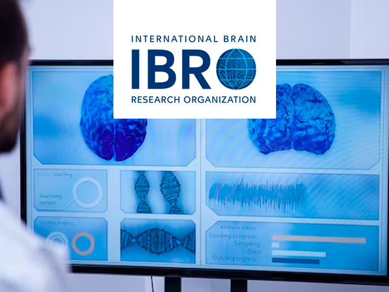 IBRO Collaborative Research Grants-Marzo